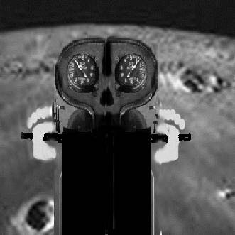 moontrike.JPG