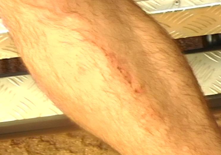 Pastmaster Shin where crocodile tail hit him.jpg