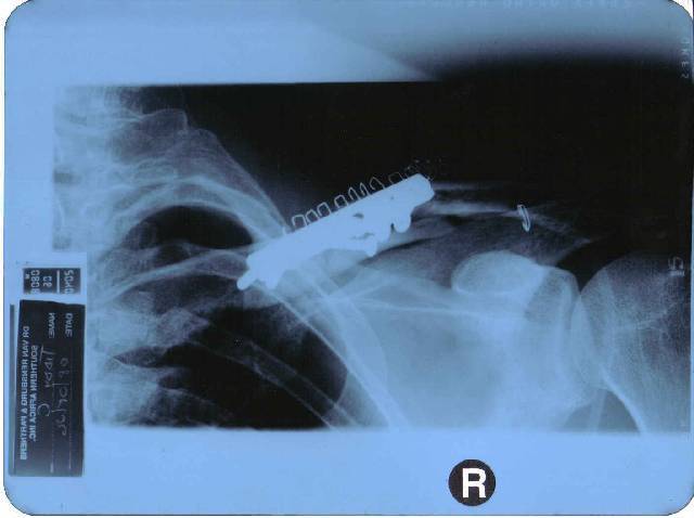 XRay.jpg